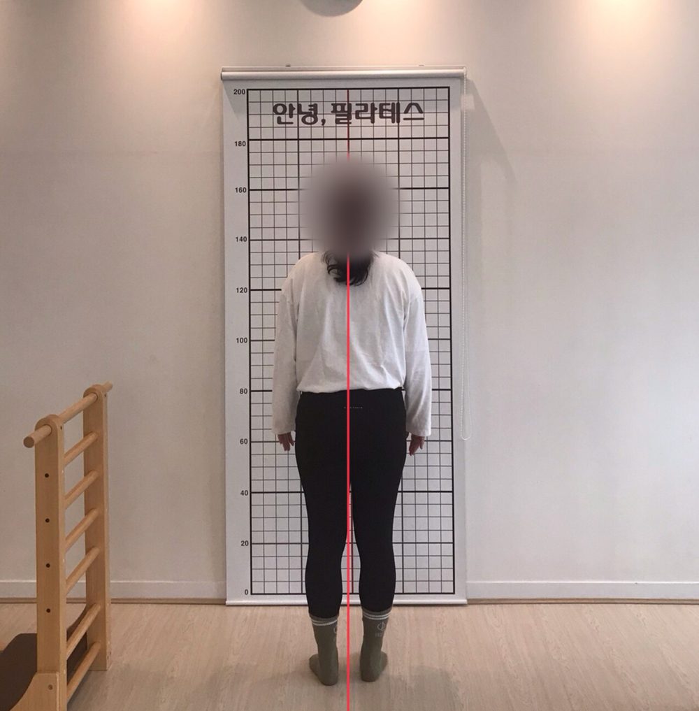 거북목 회원 정면 자세