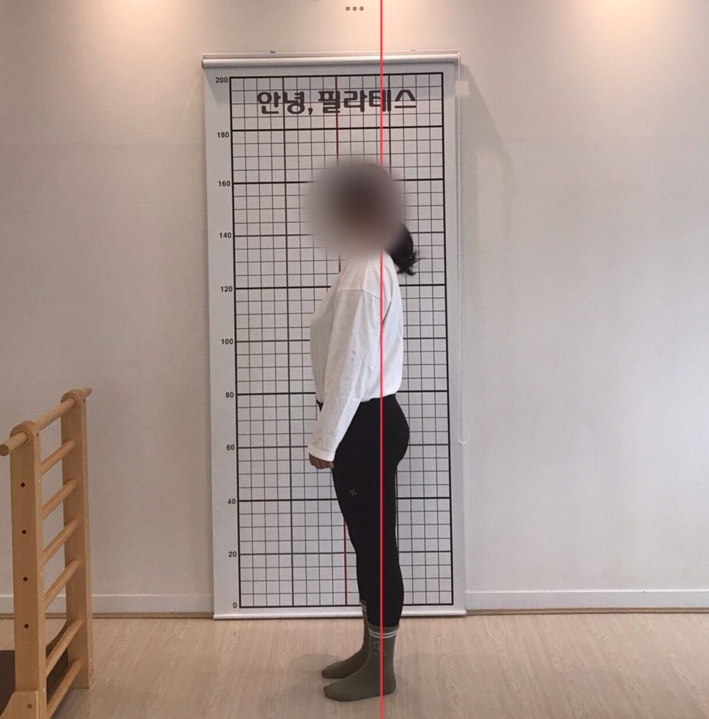 거북목·라운드숄더 회원의 옆모습 자세 평가